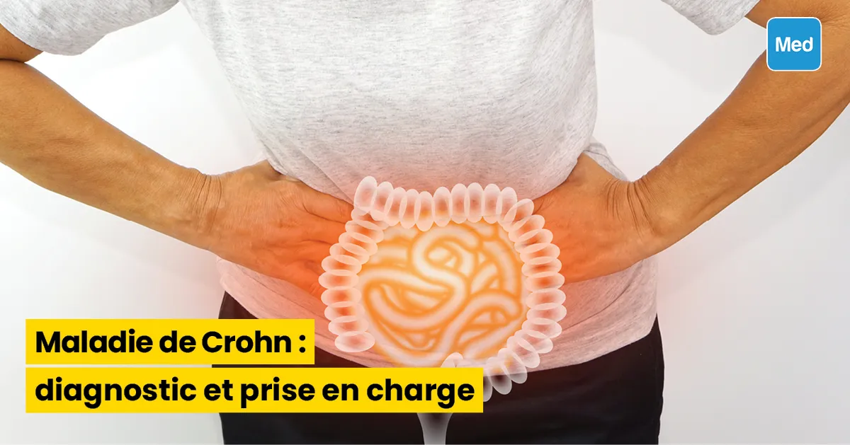 Maladie de Crohn : diagnostic et prise en charge